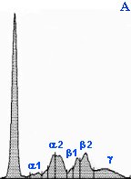 Normal electrophoretogram graph