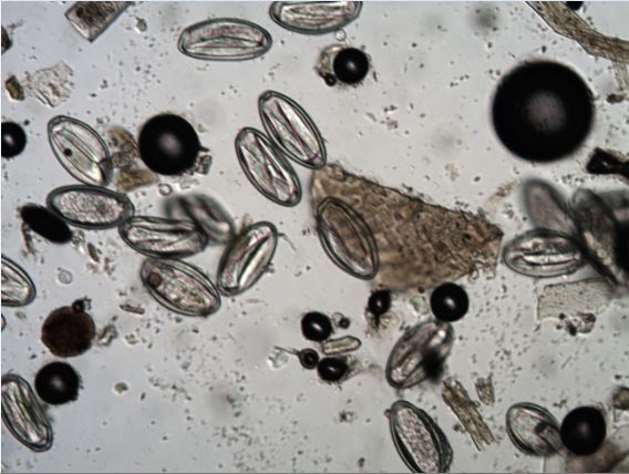 Microscopic photo of bacteria