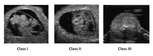 sonograph images