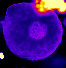 Preantral 2 full oocyte image