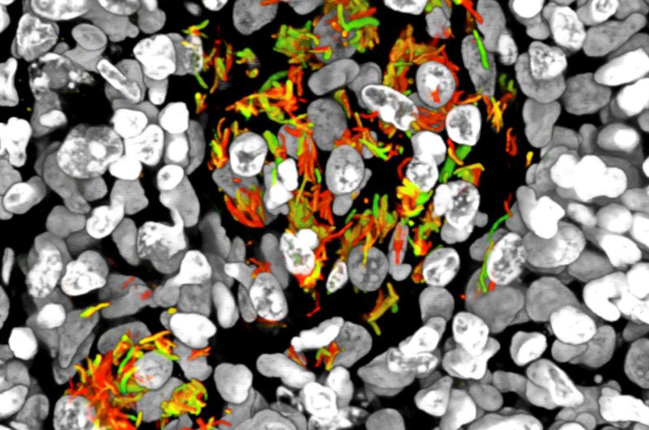 Russell-Mtb-cells