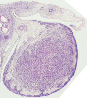 Ovary, mesonephric & Grade 0 paramesonephric duct regression, stage 23, histology, cross section, 3.2x