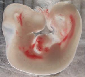 Whole embryo, stage 14, 1x