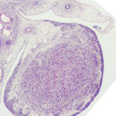 Ovary, mesonephric & Grade 0 paramesonephric duct regression, stage 23, histology, cross section, 3.2x