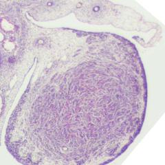 Ovary, mesonephric & Grade 0 paramesonephric duct regression, stage 23, histology, cross section, 3.2x