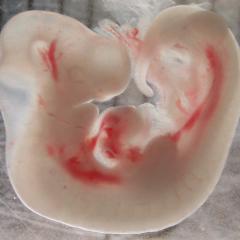 Whole embryo, stage 14, 1x