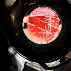 The scientist is examining the petri dish through a magnifying glass