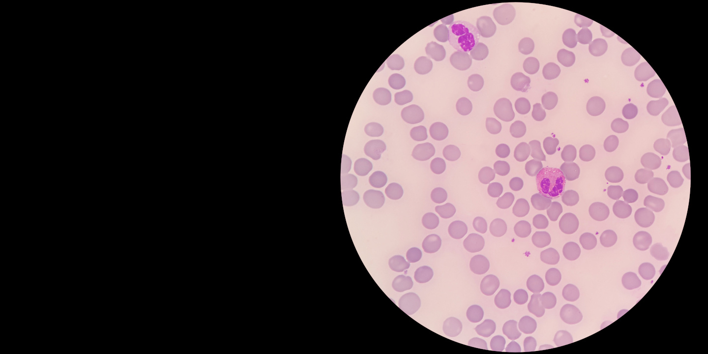 Elephant blood under a microscope