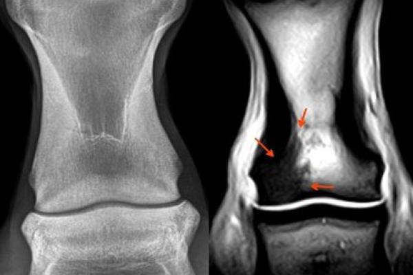 Pastern radiograph and MRI