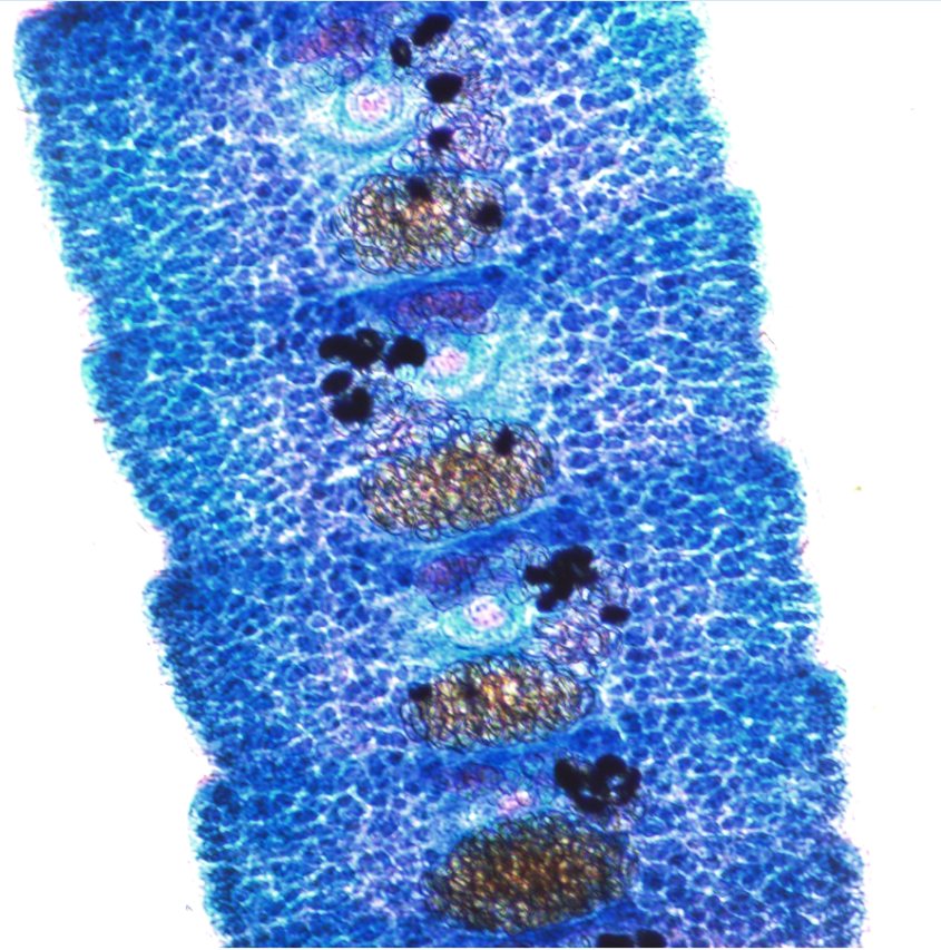 Microscopic image of a Fish Cestode