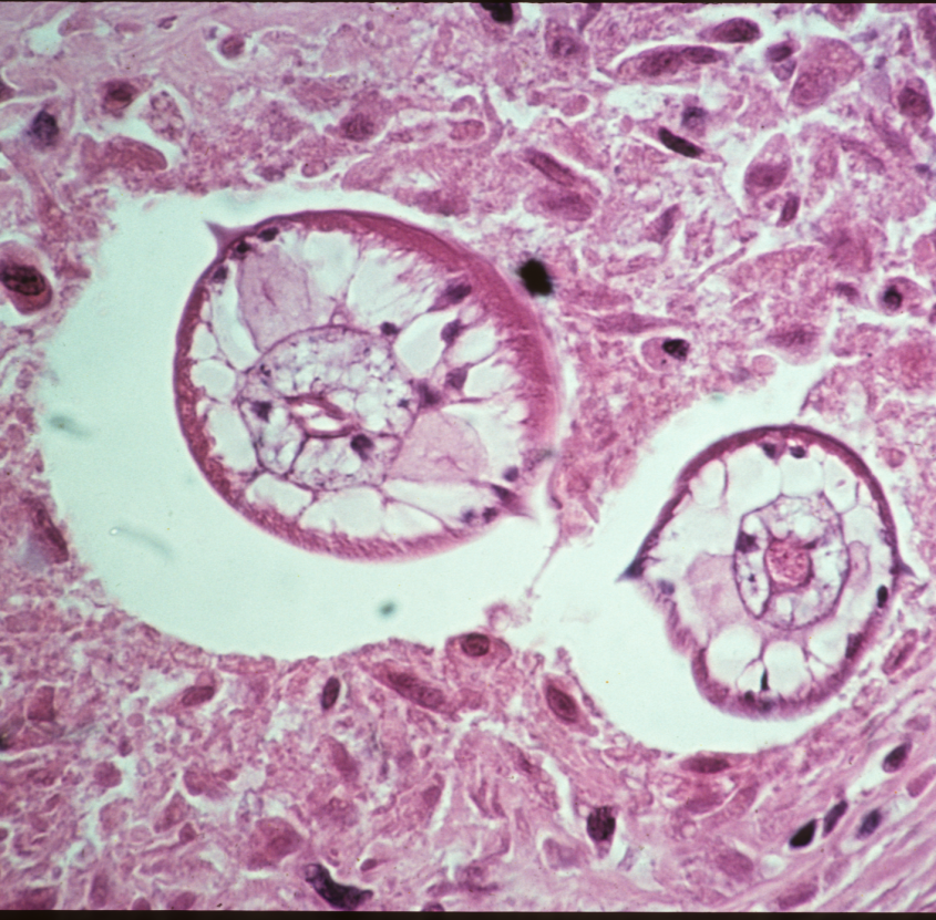 Microscopic image of a Baylisascaris (Raccoon Roundworm)