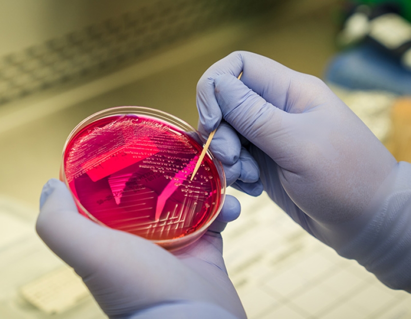 A scientist collecting bacterial colonies from a petri dish