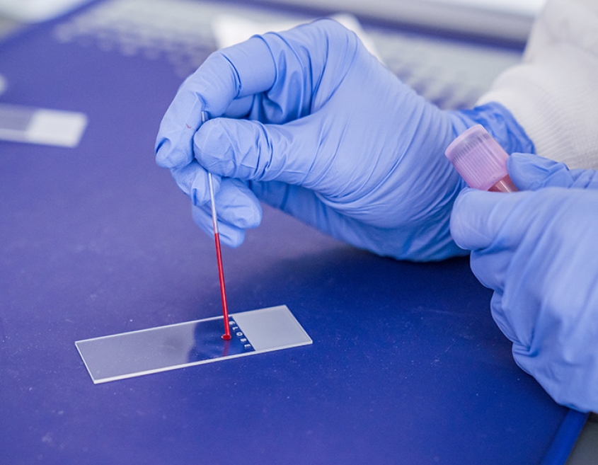 Scientist depositing a drop of blood on a microscope slide