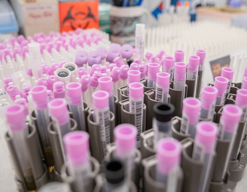 Sample tubes on a lab bench