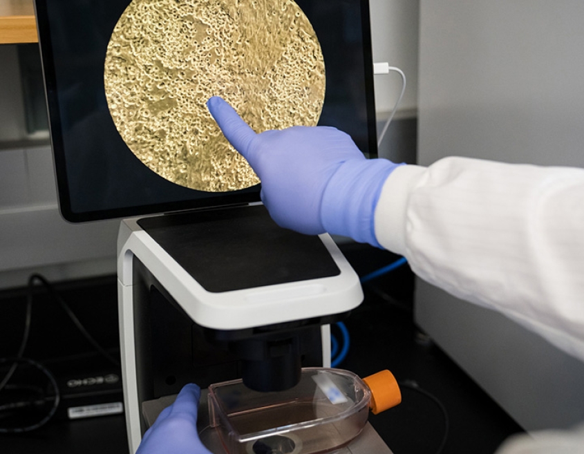 Cell culture amplified under a microscope