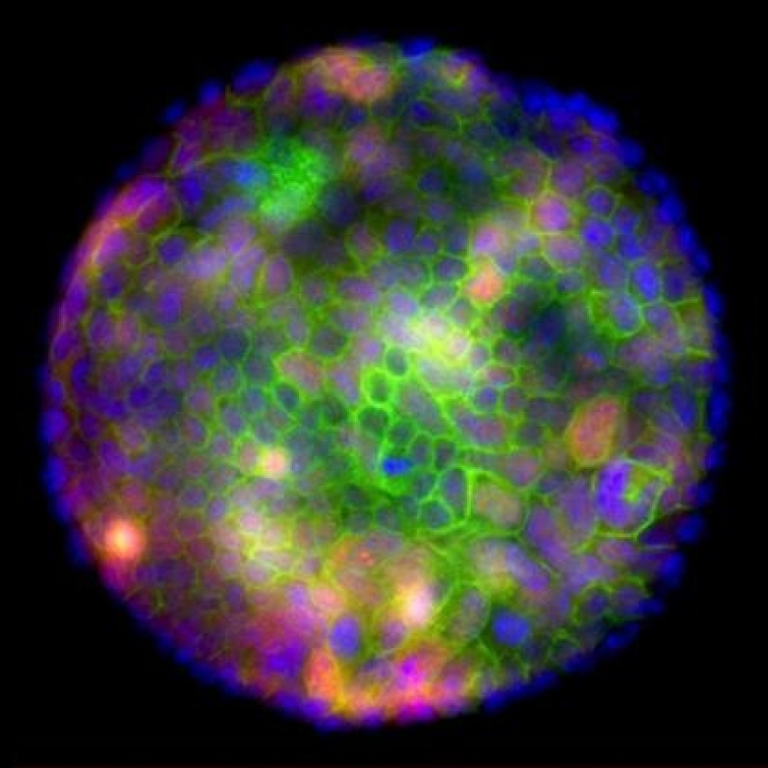 Cell under the microscope
