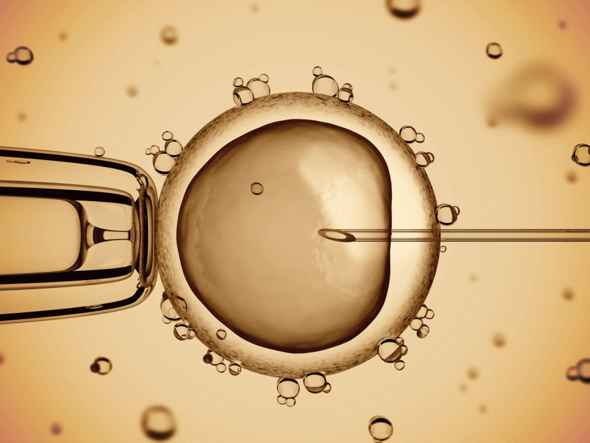 microscopic image of IVF
