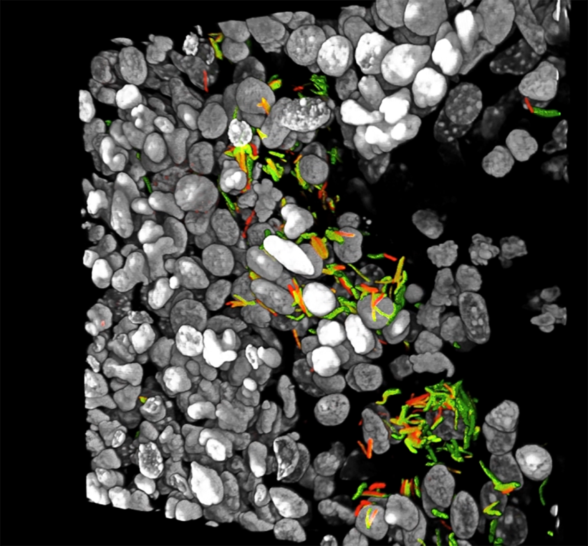 An infected mouse lung showing the host cell nuclei (grey) with healthy bacteria (red) and the stressed bacteria (green).