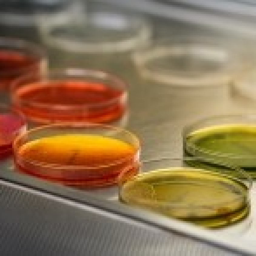 four petrie dishes of different colors