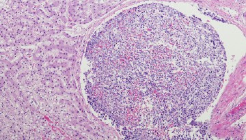 liver cells under the microscope