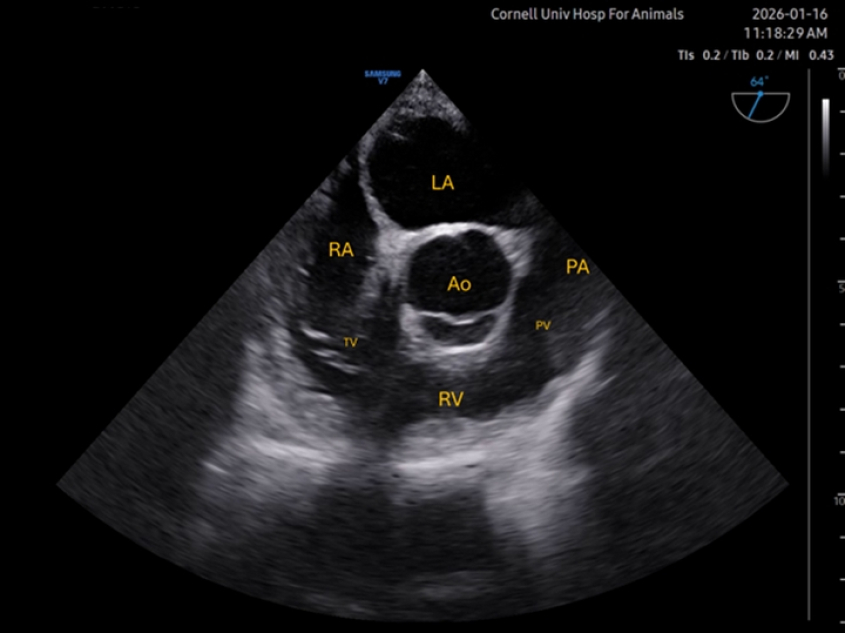 Transesophageal echocardiography of mid-esophageal right ventricular inflow-outflow