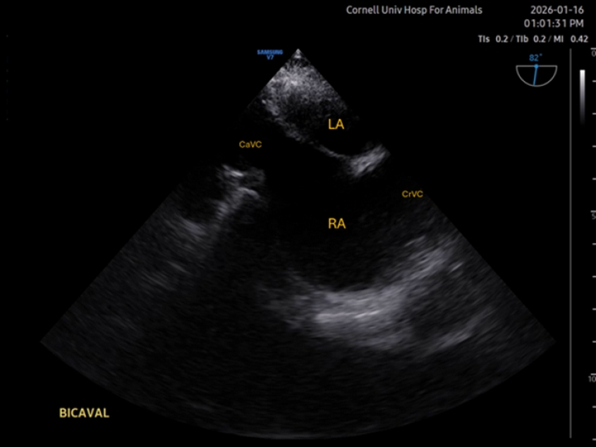 Transesophageal echocardiography of Mid-esophageal Bicaval