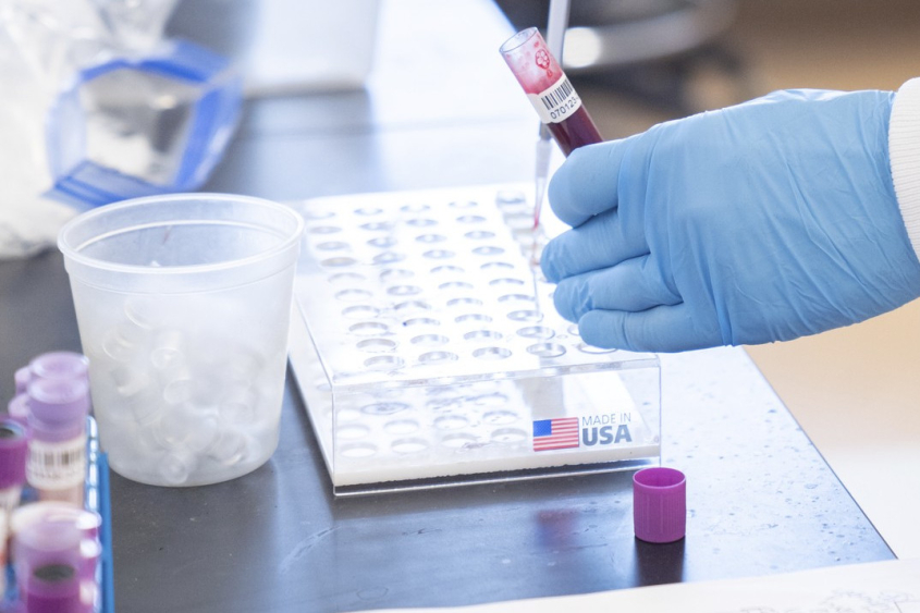 A gloved hand pipetting a liquid in a lab plate