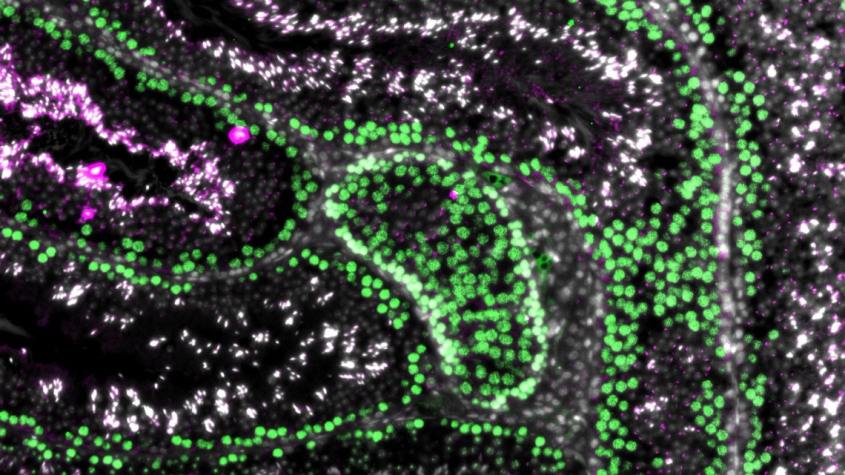 microscope image of testis tubules