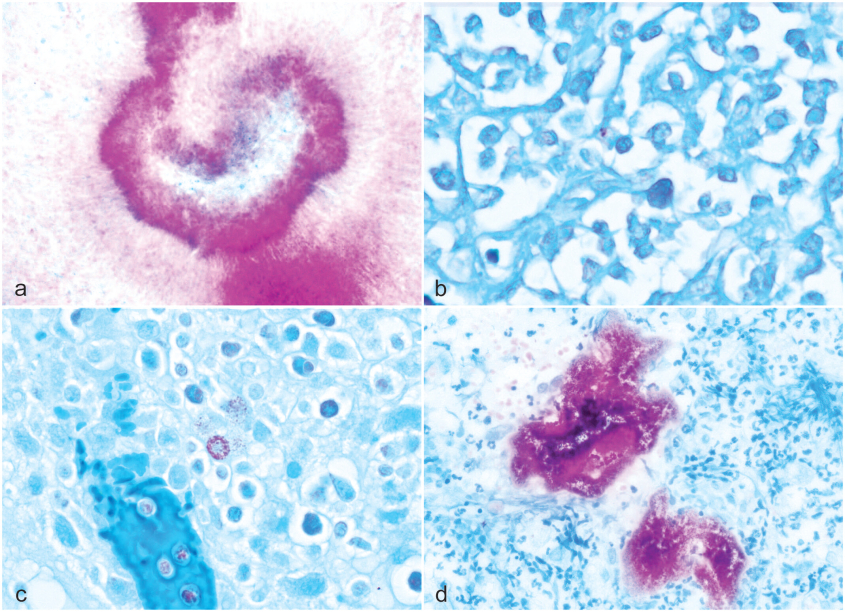 Examples of acid-fast bacteria and structures other than mycobacteria