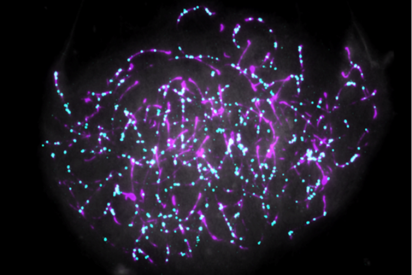 microscope view of chromosomes