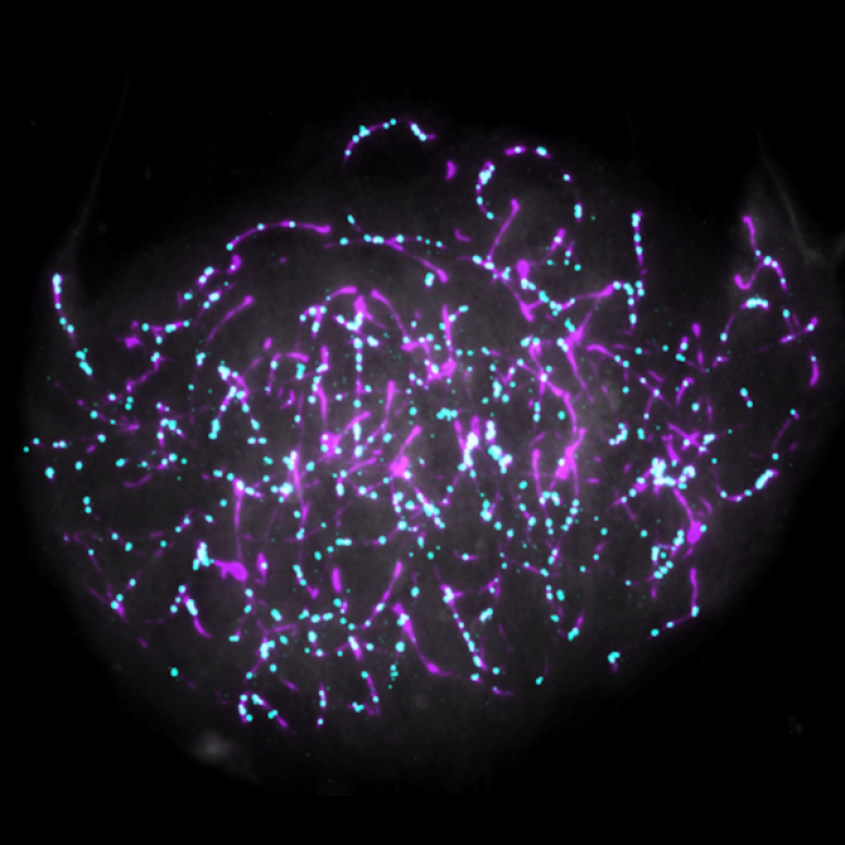 microscope view of chromosomes