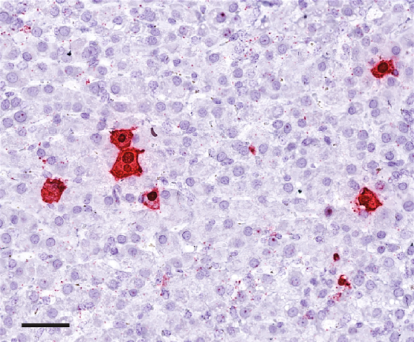 Tissue under a microscope of a horse's liver, infected with equine parvovirus-hepatitis