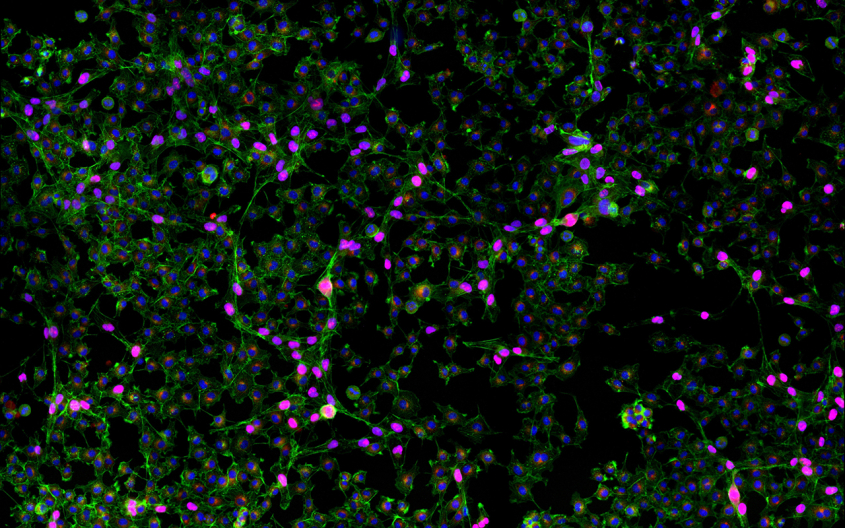 Melanoma cells