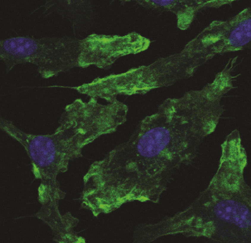 Microscopic image of macrophage cells on a glass