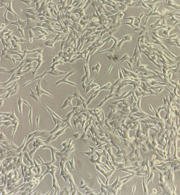 Phase contrast image of murine quasi-mesenchymal breast cancer cells