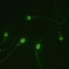 Sperm highlighted green under a microscope