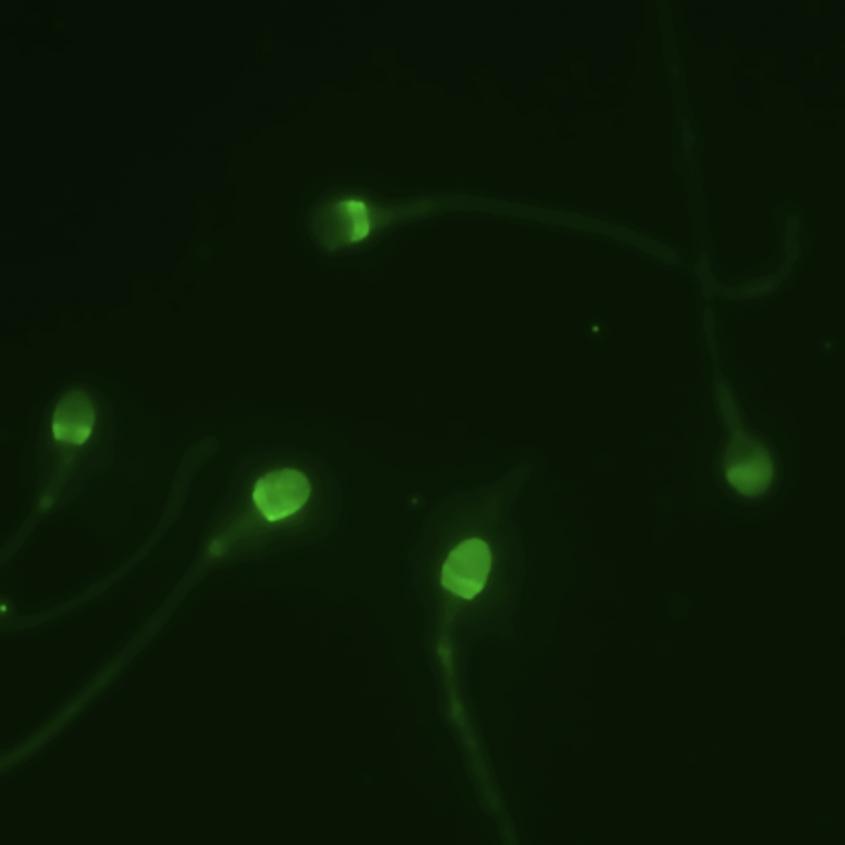 Sperm under a microscope highlighted green