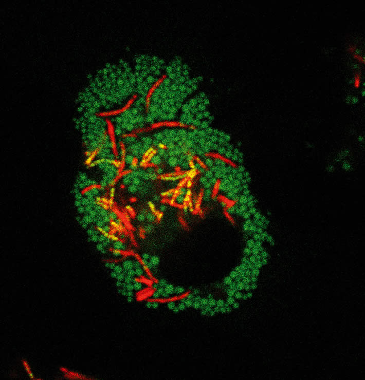 Mycobacterium tuberculosis bacteria