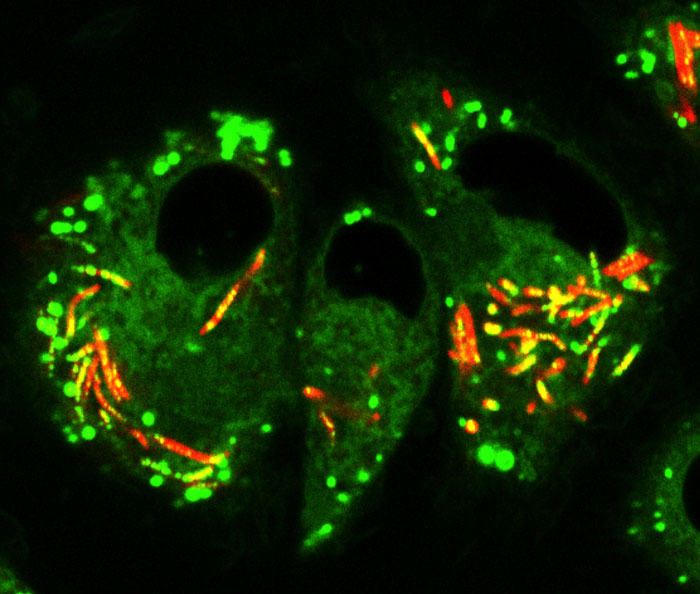 Macrophages infected with M. tuberculosis (labeled red) lipids (labeled green). Yellow puncta observed within the bacteria are host-derived lipids that the bacteria have imported.